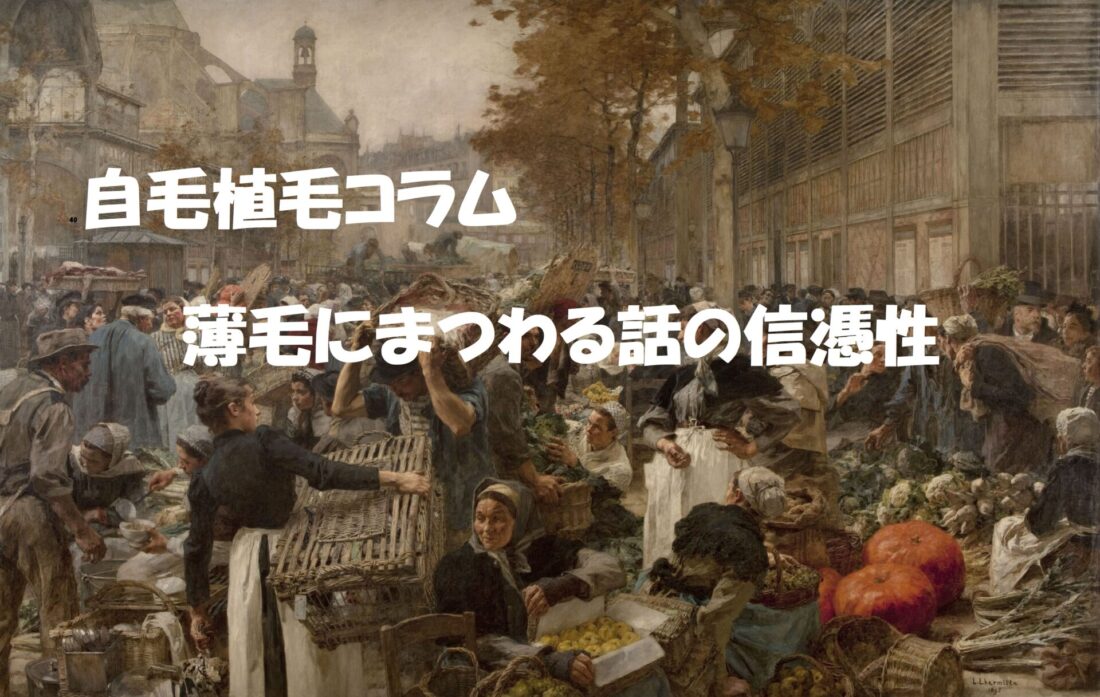 自毛植毛コラム薄毛にまつわる話の信憑性　イメージ